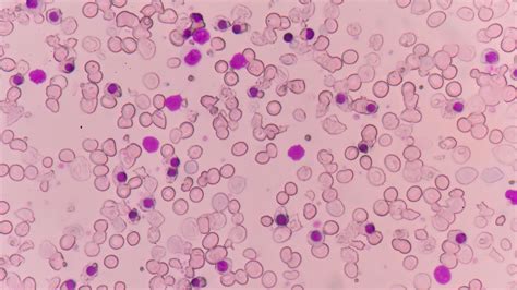 Thalassemia Cells