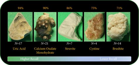 Article of the week: Deep learning computer vision algorithm for detecting kidney stone ...