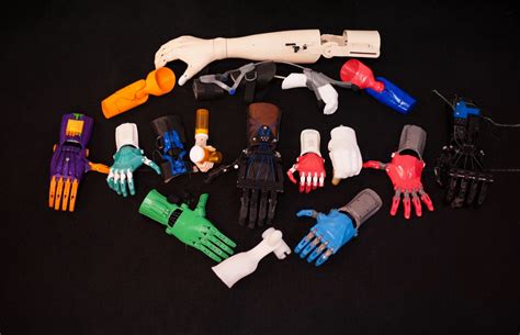 Children who need prosthetics can quickly outgrow them and insurers are ...