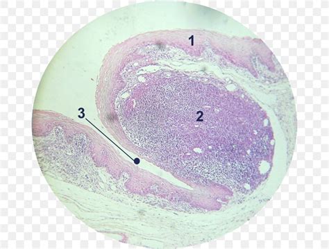 Adenoid Histology