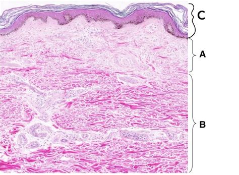 Skin Histology | Squamous, Sweat gland, Stratified squamous epithelium