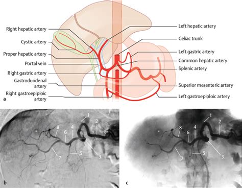 Hepatic Artery