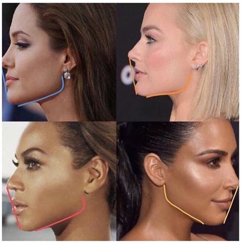 Best of Plastic Surgery on Instagram: “Who has the best side profile? ・・・ Jawline contouring ...