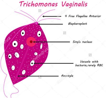 Trichomonas Vaginalis - Pictures, What is?, Treatment, Symptoms, Causes