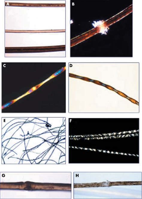 Photomicrographs of hair. (A) Appearance of normal hair shafts on... | Download Scientific Diagram