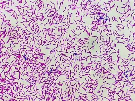 Premium Photo | Microscopic view of gram stain showing rod shape Escherichia coli or E. coli ...