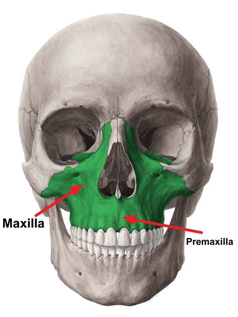 Maxillary hypoplasia causes, symptoms, diagnosis, treatment & prognosis