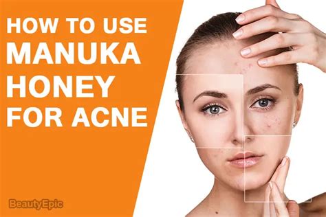 How To Use Manuka Honey For Acne?