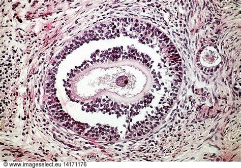 LM of Follicular Atresia LM of Follicular Atresia,female reproductive system,follicular atresia ...