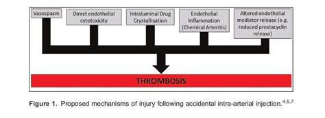 Management of Accidental Intra-Arterial Injections : WFSA - Resources