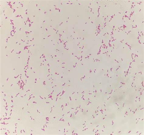 Enterobacter Gram Stain Results