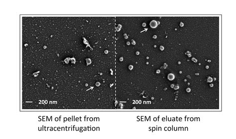 Characterization of RNA from Exosomes and Other Extracellular Vesicles Isolated by a Novel Spin ...