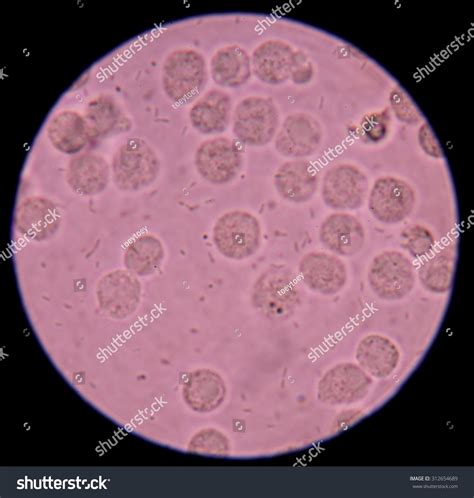 White Blood Cells Urine Specimen Under Stock Photo 312654689 | Shutterstock