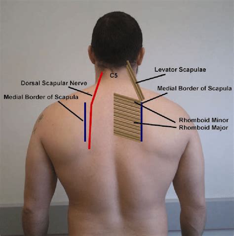 Pathway of the dorsal scapular nerve | Download Scientific Diagram