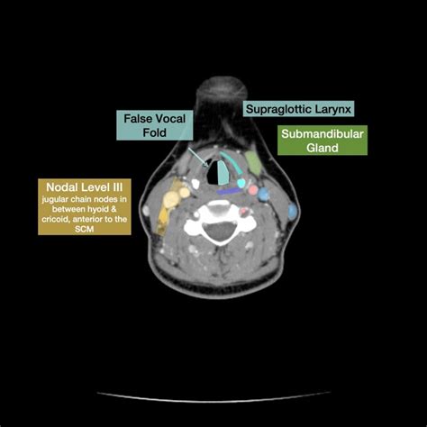 Normal Neck Ct Scan