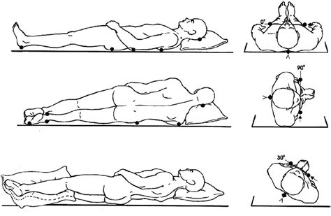 30°–40° side-lying position. | Download Scientific Diagram