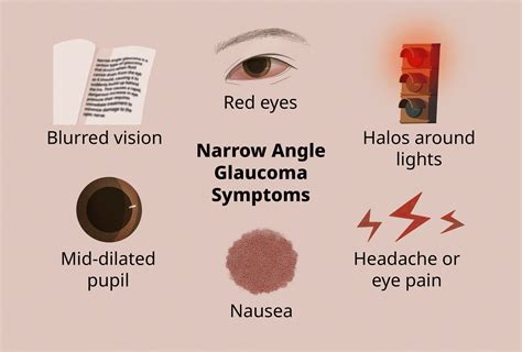 Acute Angle Closure Glaucoma Causes Symptoms Treatment