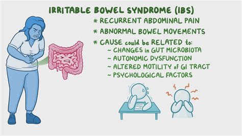 Irritable bowel syndrome: Clinical sciences - Osmosis Video Library