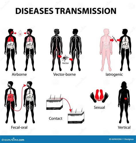 Disease transmission stock vector. Illustration of direct - 66965266