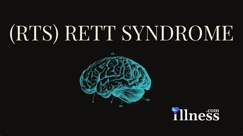 Rett Syndrome : Overview, Causes, Symptoms, Treatment - illness.com