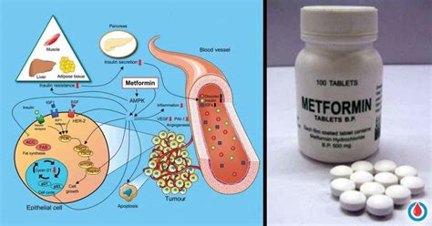 Perks and Side Effects of Taking Metformin 101 | Diabetes Health Page