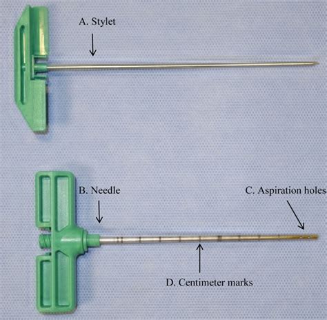 Frontiers | Biopsy Needle Advancement during Bone Marrow Aspiration Increases Mesenchymal Stem ...