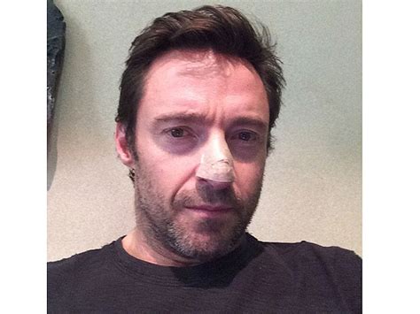 Hugh Jackman Has Kicked Skin Cancer Again! - Celeb Bistro