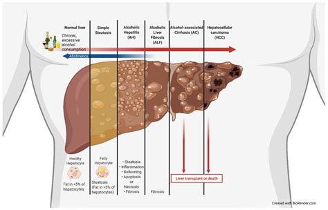 Diseased Liver