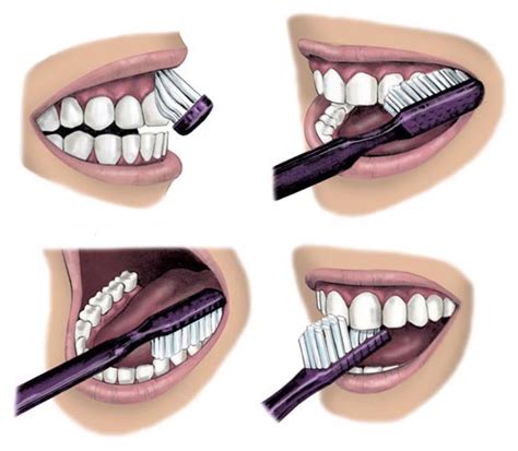 How to brush your teeth correctly - Oakwood Dental Clinic