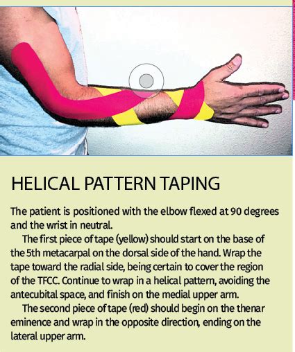 Kinesiology tape wrist cartilage injury fixes - Chiropractic Economics