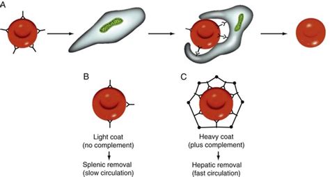 Autoimmune Hemolytic Anemia | Oncohema Key