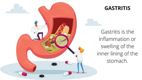 6 reasons of gastritis