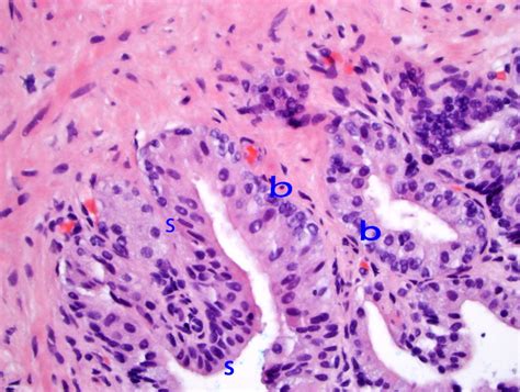 Normal Prostate Gland Histology