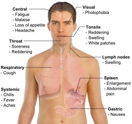 Viral Fever - Types, Causes, Treatment, Diagnosis & Prevention