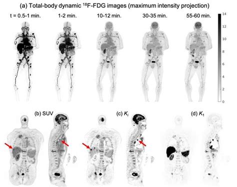 Pet Scan Cancer