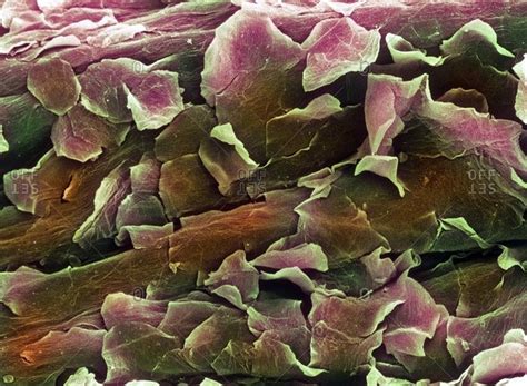 Color scanning electron micrograph of healthy human skin. The flaky outer layer is made up of ...