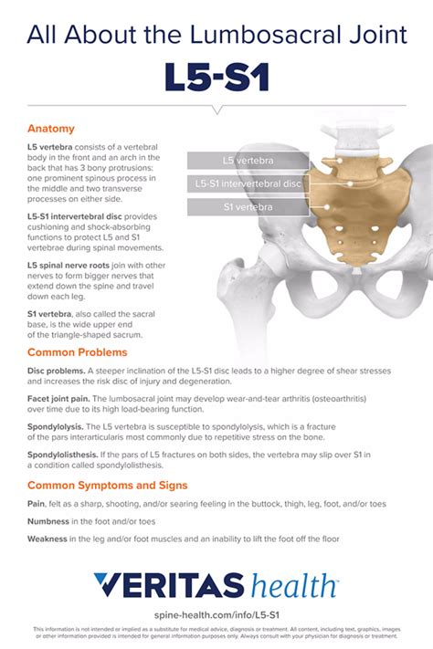 Anatomy of Lumbosacral Joint L5-S1 Infographic | Spine-health