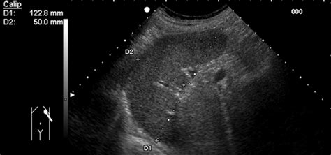 Sonography of the Spleen - Benter - 2011 - Journal of Ultrasound in Medicine - Wiley Online Library