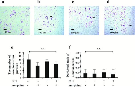 Effects of continuous administration of intrathecal (IT) morphine on... | Download Scientific ...