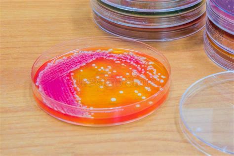 Bacterial Culture Growth on Agar Plate. Stock Photo - Image of colony ...