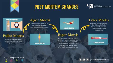 Livor Mortis Stages