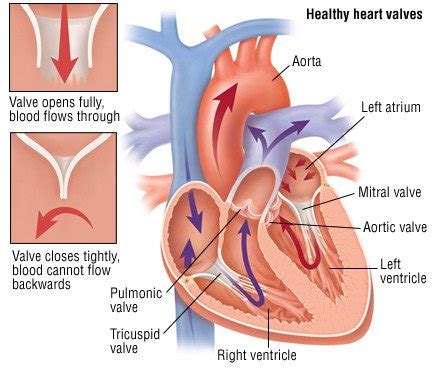 Heart Valve Replacement Guide | Drugs.com