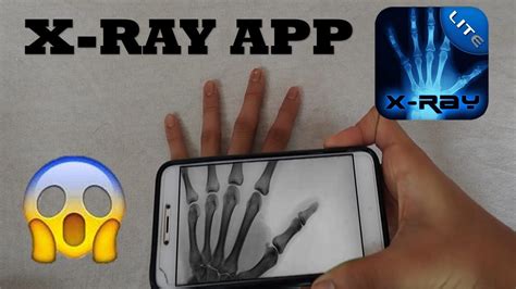 X-Ray App - YouTube