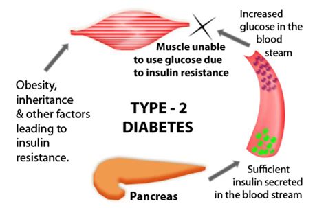 Type 2 Diabetes - The DANII Foundation