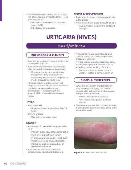 Urticaria | Osmosis