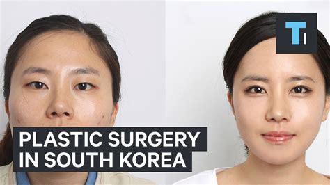 Plastic surgery in South Korea - YouTube