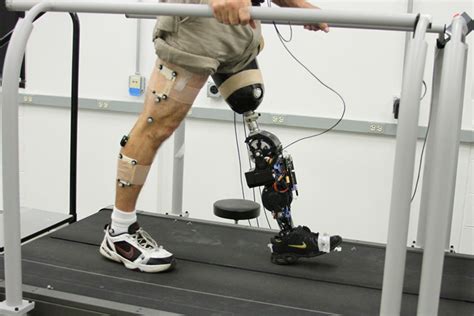 Alumnus’ Design of Powered Prosthetic Leg Aims To Give Amputees More ...