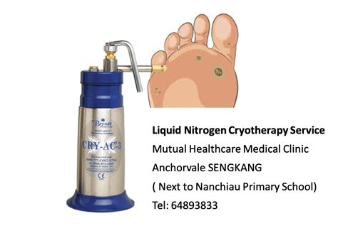 Viral Warts Treatment – Liquid Nitrogen Cryotherapy – Mutual Healthcare