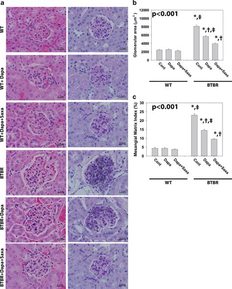 a Representative pictures of H&E and PAS reagent staining of the kidney... | Download Scientific ...