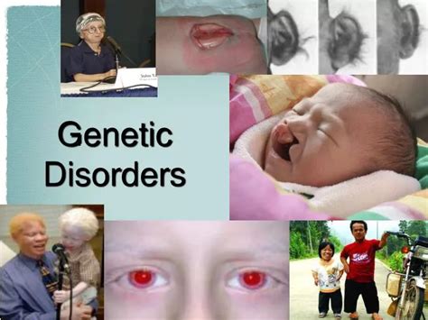 Genetic Disorders Visual at Donald Chaney blog